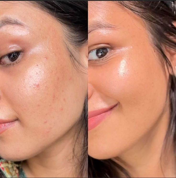 Glycolic Acid 7% Toning Solution